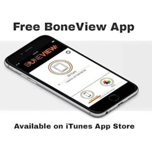 Visor de cámara Trail para iPhone lector de tarjetas de_3