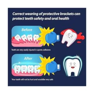 Protector bucal juvenil de fútbol deportivo para frenos_3