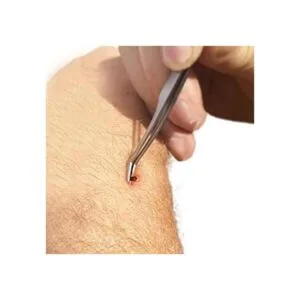 Herramienta para quitar garrapatas eTradewinds TickOff_6