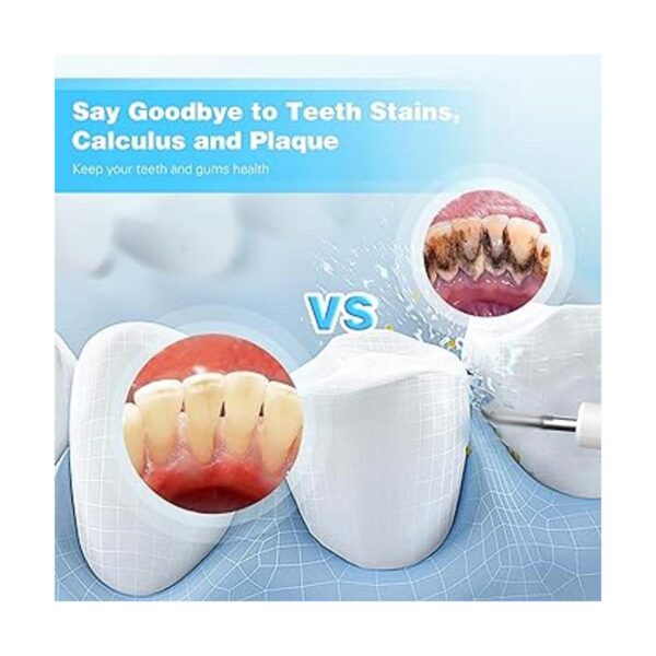 Removedor de placa para dientes kit de limpieza de_5